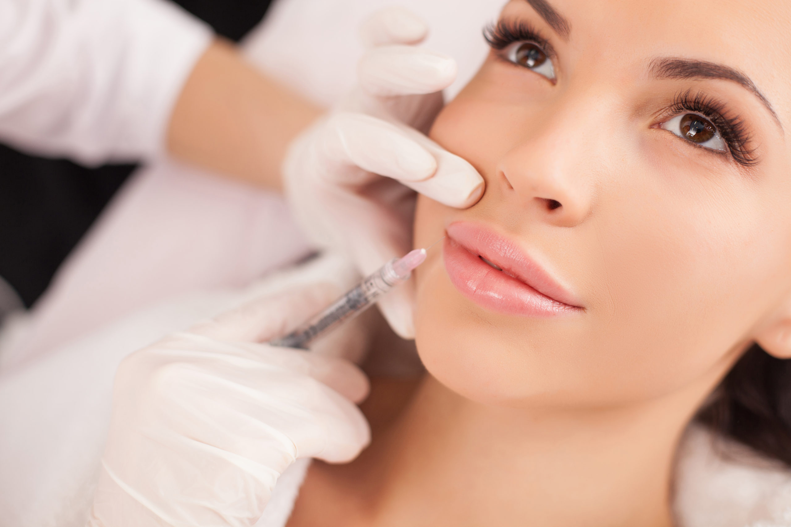 A Woman getting injection near Lips | Get Dermal Fillers in SOSA Medical Aesthetics at Tampa, FL